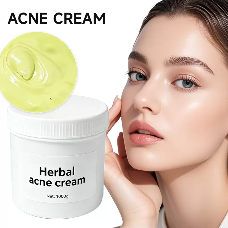 HERBAL ACNE CREAM